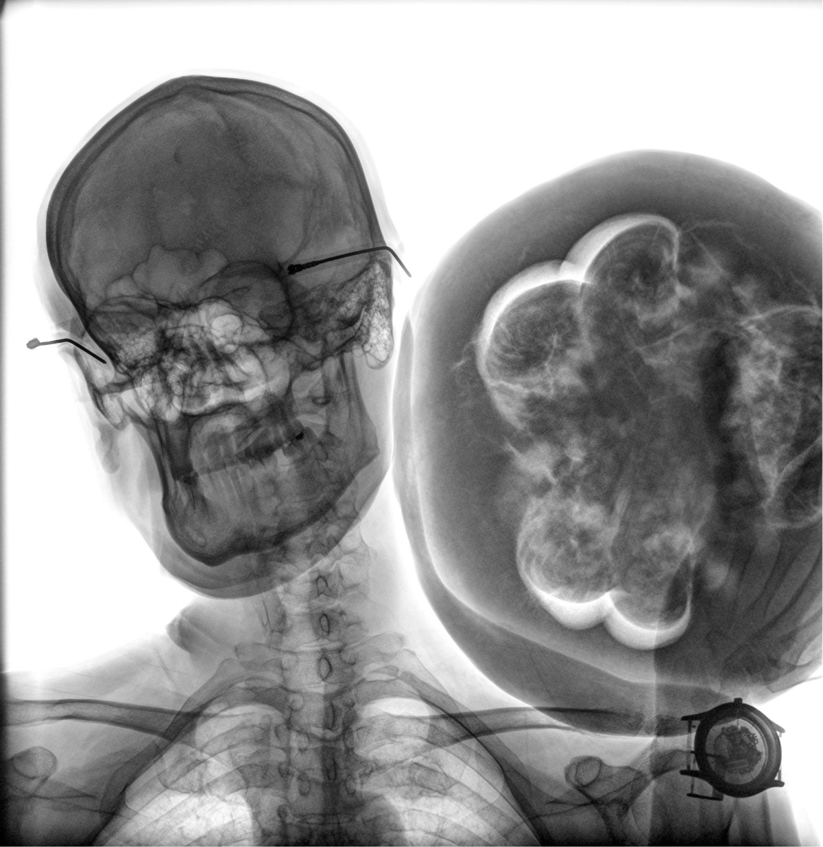 Hombre con sandía, Autorretrato